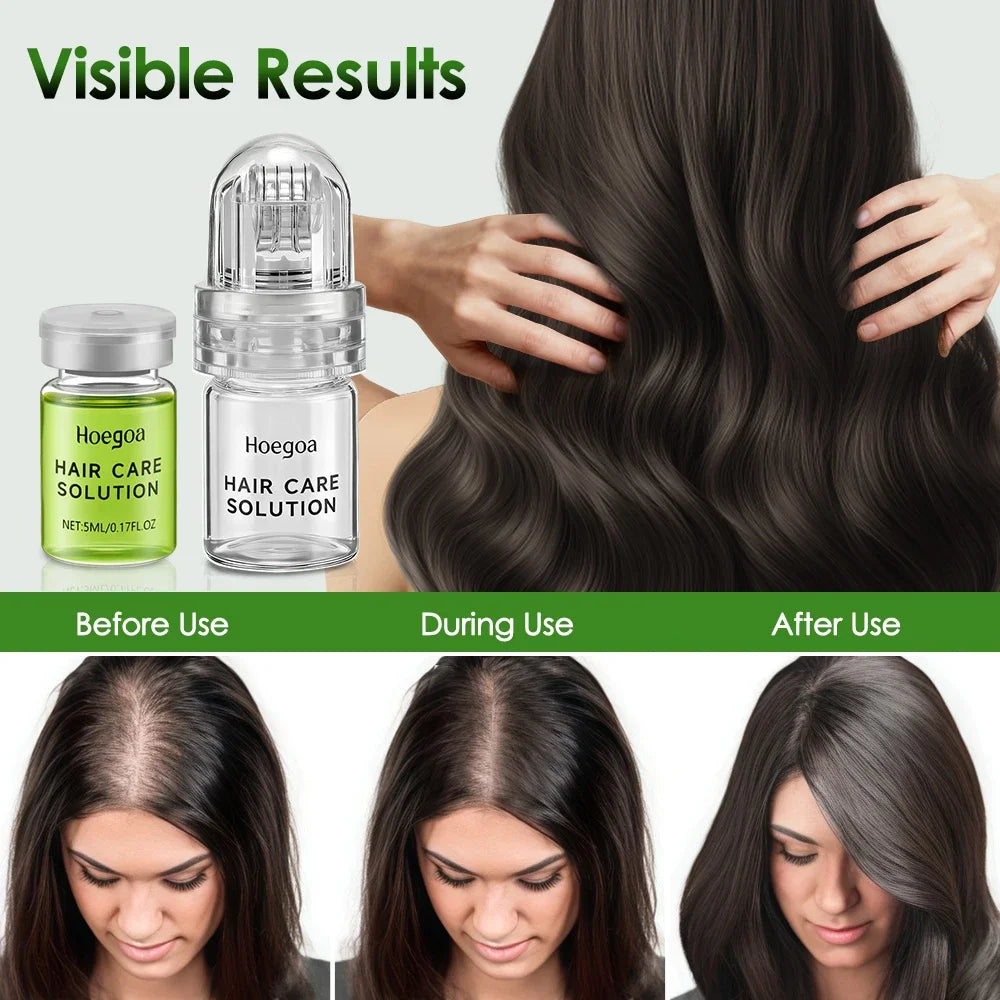 Anti-Hair Loss Scalp Serum – Strengthens Roots & Reduces Shedding